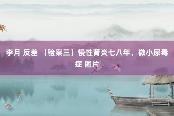 李月 反差 【验案三】慢性肾炎七八年，微小尿毒症 图片